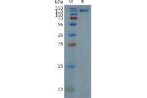 Human Her2 Protein, hFc Tag on SDS-PAGE under reducing condition.