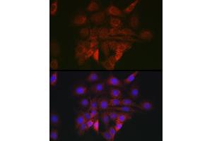Immunofluorescence analysis of PC-12 cells using BiP/GRP78 Rabbit pAb (ABIN6134514, ABIN6142042, ABIN6142044 and ABIN6215180) at dilution of 1:100 (40x lens).