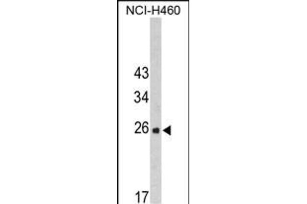 FKBP14 anticorps  (N-Term)