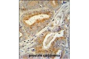 Immunohistochemistry (Paraffin-embedded Sections) (IHC (p)) image for anti-BCL6 Corepressor-Like 1 (BCORL1) (AA 69-98), (N-Term) antibody (ABIN654801)