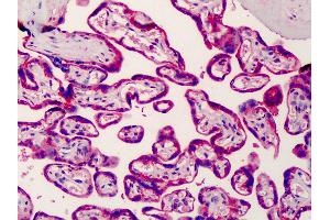 Immunohistochemistry (IHC) image for anti-Sterol Regulatory Element Binding Transcription Factor 2 (SREBF2) (AA 434-483) antibody (ABIN6736431)