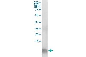 FABP1 (Human) IP-WB Antibody Pair