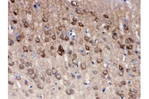 Anti- PGP9. (UCHL1 Antikörper  (C-Term))