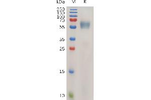 Human IL1RAP Protein, His Tag on SDS-PAGE under reducing condition. (IL1RAP Protein (AA 21-359) (His tag))