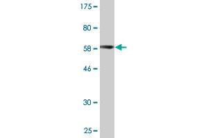 Western Blot detection against Immunogen (62. (PARVG Antikörper  (AA 1-331))