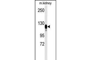 Western blot analysis of anti-EGFR Antibody  s in kidney heart tissue lysates (35 μg/lane). (EGFR Antikörper  (AA 1048-1077))
