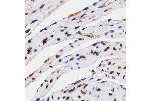 Immunohistochemistry (IHC) image for anti-High Mobility Group Box 1 (HMGB1) (AA 100-200) antibody (ABIN3023358) (HMGB1 Antikörper  (AA 100-200))