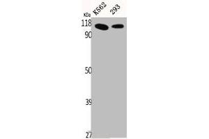 Western Blot analysis of K562 293 cells using p115 Polyclonal Antibody (USO1 Antikörper  (C-Term))