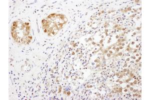 Immunohistochemistry (IHC) image for anti-Translin-Associated Factor X (TSNAX) (AA 240-290) antibody (ABIN7453532)
