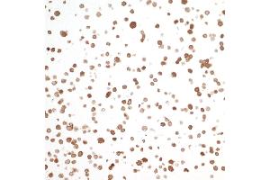 Immunocytochemistry (ICC) image for anti-Nicotinamide phosphoribosyltransferase (NAMPT) (AA 400-450) antibody (ABIN7454014)