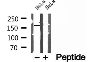 Western blot analysis of extracts of HeLa cells, using PTPN23 antibody. (PTPN23 Antikörper  (C-Term))