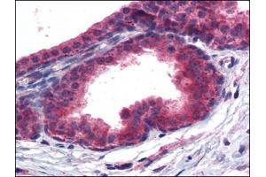 Immunohistochemistry Image: Human Prostate: Formalin-Fixed, Paraffin-Embedded (FFPE) (PPARD Antikörper  (C-Term))