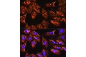 Immunofluorescence (IF) image for anti-Ribosomal Protein S3 (RPS3) (AA 1-243) antibody (ABIN3023343)