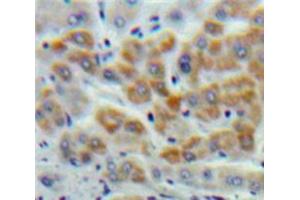 Used in DAB staining on fromalin fixed paraffin-embedded Liver tissue (Cystathionine (AA 14-224) Antikörper)