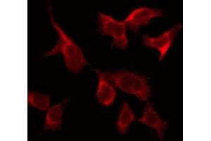 ABIN6269109 staining 293 by IF/ICC. (CSF1R Antikörper  (C-Term))
