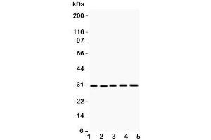 Western blot testing of CD82 antibody and Lane 1:  HL-60;  2: CEM;  3: HUT;  4: U937;  5: MCF-7 (CD82 Antikörper  (AA 98-267))