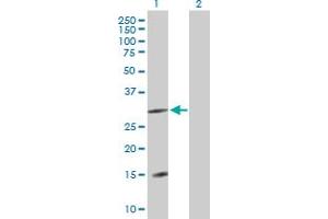 Western Blot analysis of DNAJC22 expression in transfected 293T cell line by DNAJC22 MaxPab polyclonal antibody. (DNAJC22 Antikörper  (AA 1-341))