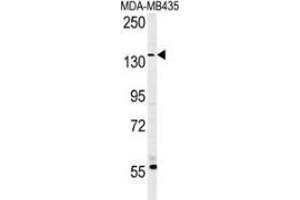 Western blot analysis in MDA-MB435 cell line lysates (35ug/lane) using CD227 / Mucin-1 / MUC1 Antibody . (MUC1 Antikörper  (AA 1209-1239))