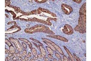 Immunohistochemistry (IHC) image for anti-Keratin 19 (KRT19) (C-Term) antibody (ABIN870578) (Cytokeratin 19 Antikörper  (C-Term))