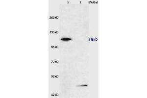 Lane 1: mouse testis lysates Lane 2: mouse pancreas lysates probed with Anti phospho-FAK(Ser722) Polyclonal Antibody, Unconjugated (ABIN711056) at 1:200 in 4 °C. (FAK Antikörper  (pSer722))