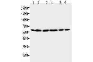 Anti-HSP60 antibody, Western blotting Lane 1: Rat Brain Tissue Lysate Lane 2: Rat Liver Tissue Lysate Lane 3: CEM Cell Lysate Lane 4: HELA Cell Lysate Lane 5: SMMC Cell Lysate Lane 6: COLO320 Cell Lysate (HSPD1 Antikörper  (C-Term))