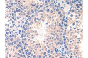 DAB staining on IHC-P; Samples: Mouse Testis Tissue (nectin-3 Antikörper  (AA 90-293))