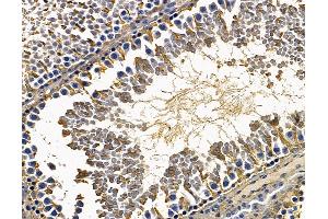 ABIN7095037 and ABIN7099093 at 1/100 staining rat testis tissue by IHC-P. (CCDC39 Antikörper)