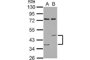 WB Image Sample (30 ug of whole cell lysate) A: A549 B: H1299 10% SDS PAGE antibody diluted at 1:1000 (Lipase A Antikörper  (Center))