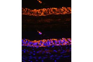 Immunofluorescence (IF) image for anti-Keratin 7 (KRT7) (AA 1-94) antibody (ABIN6143037)
