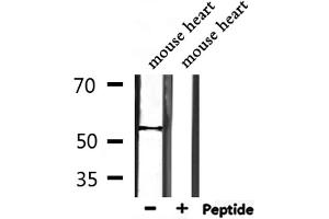 Western blot analysis of extracts from mouse heart, using TRMT11 Antibody. (Trmt11 Antikörper  (C-Term))