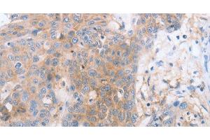 Immunohistochemistry (Paraffin-embedded Sections) (IHC (p)) image for anti-Leukocyte Immunoglobulin-Like Receptor, Subfamily B (With TM and ITIM Domains), Member 2 (LILRB2) antibody (ABIN7244522)