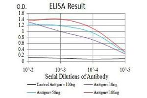 Black line: Control Antigen (100 ng),Purple line: Antigen (10 ng), Blue line: Antigen (50 ng), Red line:Antigen (100 ng) (IGHM Antikörper  (AA 310-452))