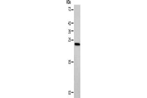 Western blot analysis of Hela cells using VSNL1 Polyclonal Antibody at dilution of 1:900 (VSNL1 Antikörper)