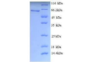 SDS-PAGE (SDS) image for K(lysine) Acetyltransferase 5 (KAT5) (AA 3-513), (partial) protein (His tag) (ABIN4984167) (KAT5 Protein (AA 3-513, partial) (His tag))