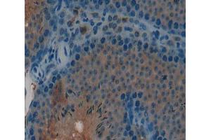 Used in DAB staining on fromalin fixed paraffin- embedded Kidney tissue (CGB Antikörper  (AA 55-153))