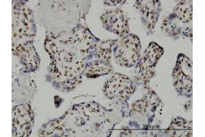 Image no. 2 for anti-TAF7 RNA Polymerase II, TATA Box Binding Protein (TBP)-Associated Factor, 55kDa (TAF7) (AA 130-224) antibody (ABIN598954) (TAF7 Antikörper  (AA 130-224))