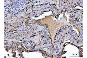 IHC analysis of PTRF/CAVIN1 using anti-PTRF/CAVIN1 antibody (ABIN7601817).
