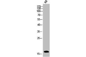 Western Blot analysis of KB cells using Phospho-Histone H3 (S10) Polyclonal Antibody (HIST1H3A/HIST2H3A/H3F3A (pSer10) Antikörper)