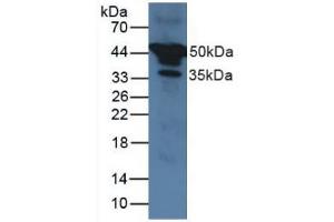 Western blot analysis of Human Serum. (SERPINA1 Antikörper  (AA 25-418))
