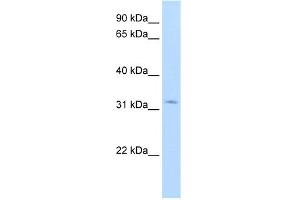 WB Suggested Anti-HSD17B6 Antibody Titration:  1. (HSD17B6 Antikörper  (N-Term))