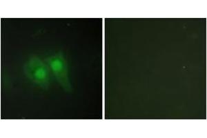 Immunofluorescence analysis of HeLa cells, using STEA3 Antibody. (STEAP3 Antikörper  (AA 421-470))