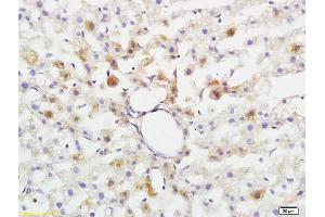 Formalin-fixed and paraffin embedded rat brain tissue labeled with Anti-ABHD5 Polyclonal Antibody, Unconjugated (ABIN708596) at 1:200 followed by conjugation to the secondary antibody and DAB staining (ABHD5 Antikörper  (AA 281-349))