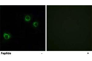 Immunofluorescence analysis of HUVEC cells, using CLDN6 polyclonal antibody . (Claudin 6 Antikörper)