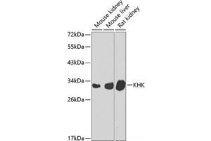Western blot analysis of extracts of various cell lines using KHK Polyclonal Antibody at dilution of 1:1000. (Ketohexokinase Antikörper)