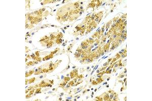 Immunohistochemistry of paraffin-embedded Human gastric using ATP6AP1 antibody at dilution of 1:100 (x400 lens). (ATP6AP1 Antikörper)