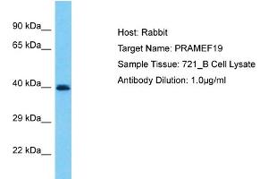 Host: Rabbit Target Name: PRAMEF19 Sample Type: 721_B Whole Cell lysates Antibody Dilution: 1. (PRAMEF19 Antikörper  (N-Term))