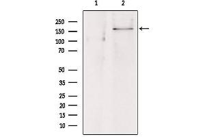 Western blot analysis of extracts from hepg2, using ABCC8 Antibody. (ABCC8 Antikörper)