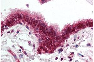 Human Lung, Respiratory Epithelium (formalin-fixed, paraffin-embedded) stained with SKIL antibody ABIN295508 at 5 ug/ml followed by biotinylated goat anti-rabbit IgG secondary antibody ABIN481713, alkaline phosphatase-streptavidin and chromogen. (SKIL Antikörper  (AA 600-684))