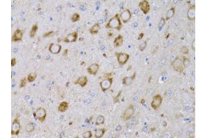 Immunohistochemistry of paraffin-embedded rat brain using NGF antibody (ABIN6293296) at dilution of 1:75 (40x lens). (Nerve Growth Factor Antikörper)