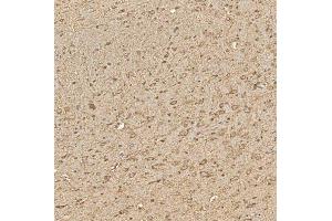 IHC analysis of SPTBN2 using anti-SPTBN2 antibody (ABIN7602111).